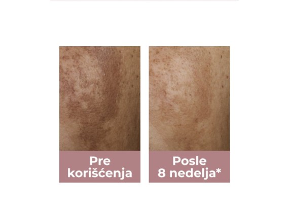 Eucerin Antipigment dvofazni serum