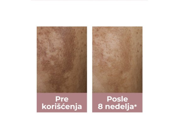 Eucerin Antipigment noćna krema 50 ml