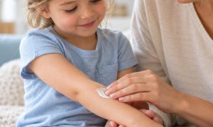 Atopijski dermatitis: simptomi, nega atopične kože i izbor kreme