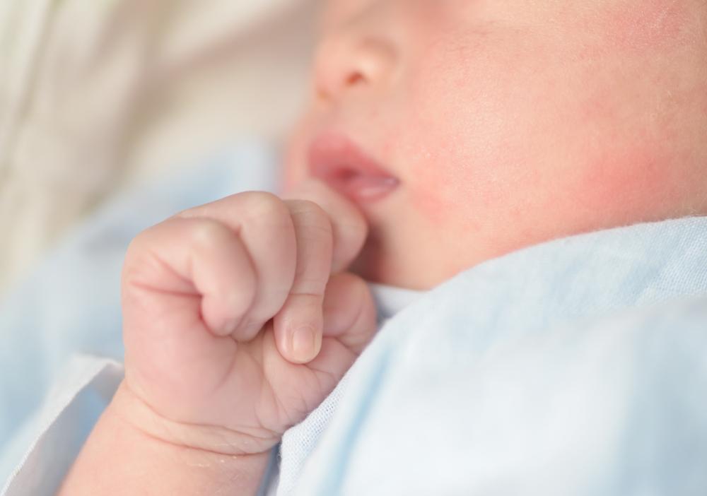 atopijski dermatitis na obrazima bebe